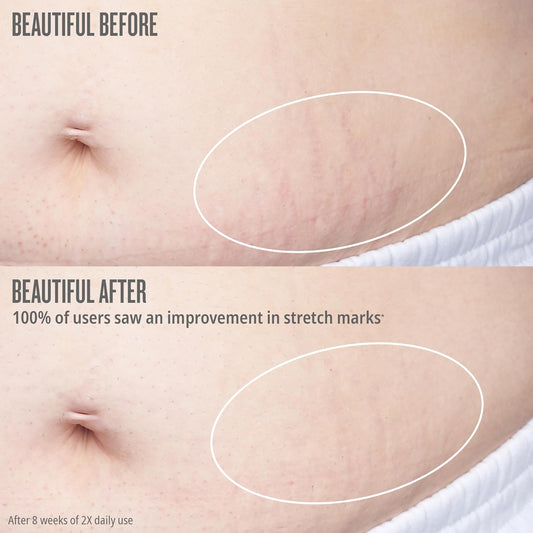 Sol De Janeiro Bum Bum Firmeza Body Oil - Stretch Mark Oil